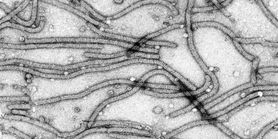 Electron micrograph of the CYVCV-strain